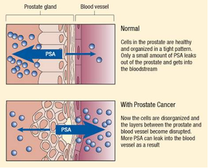 the psa test